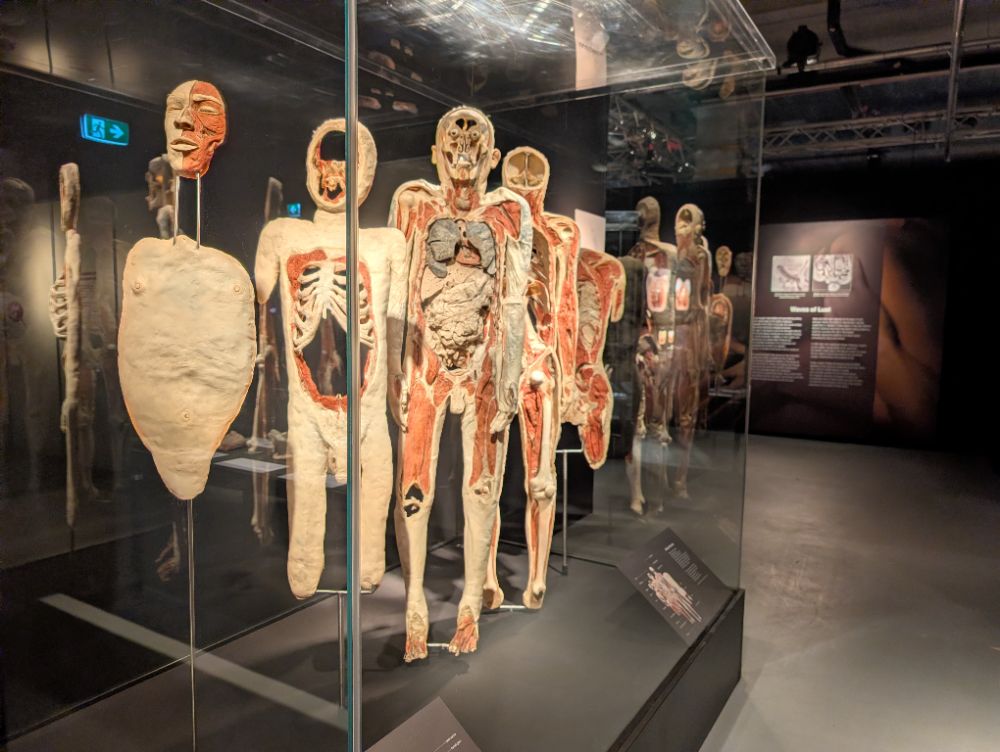 BODY WORLDS Melbourne - image by Amy Gardner