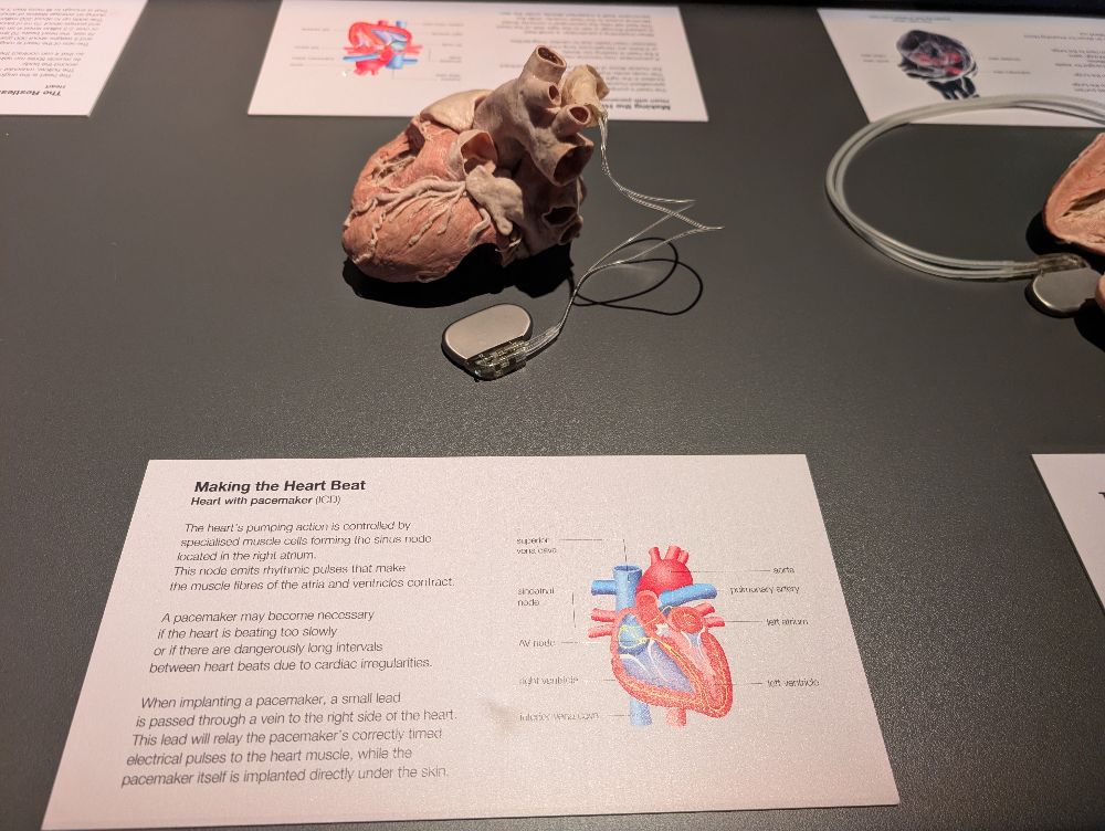 BODY WORLDS Melbourne - image by Amy Gardner