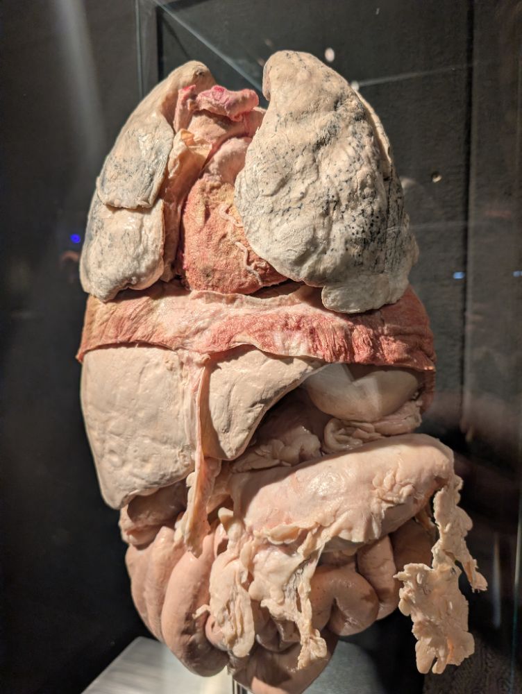 BODY WORLDS Melbourne - image by Amy Gardner